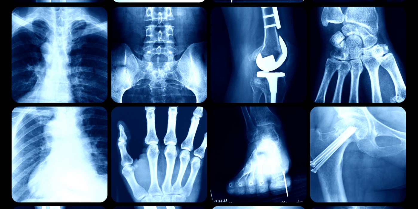 x ray images